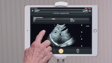 Clarius Feature: Ending an Exam and Uploading to the Cloud