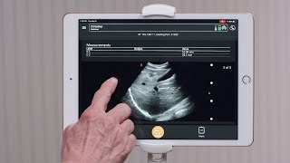 Clarius Feature: Ending an Exam and Uploading to the Cloud screenshot 3