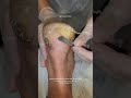 Callus Removal in Progress (So Satisfying) by Miss Foot Fixer Marion Yau