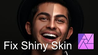 Fix Shiny Skin with Affinity Photo