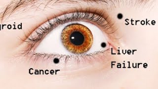 What Does Your EYES Say About Your HEALTH?