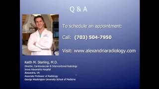 Your Uterine Fibroid Embolization (UFE) Procedure - What to Expect
