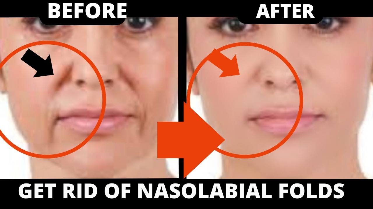 how-to-get-rid-of-nasolabial-folds-with-face-yoga-saggy-skin-jowls