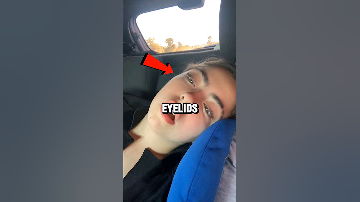 Eye open sleep