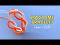 This Bracelet Always Gets Attention ✨ Easy Two-Color Bracelet