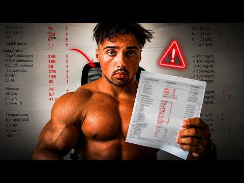 BODYBUILDER REVEALS BLOOD WORK AFTER ANABOLIC ABUSE.