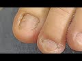 Pedicure July 24 Satisfying Pedicure July 24 Satisfying