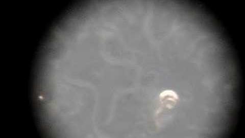 unc mutation in C.elegans