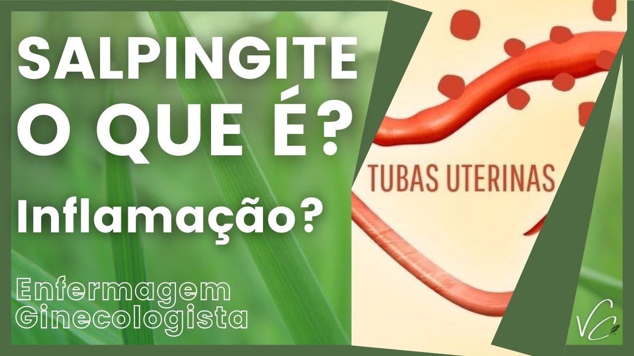 Salpingite crônica: o que é, sintomas, causas e tratamento - Tua Saúde