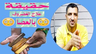 هل علاج الغضروف بالعصايا الخشبيه يصيب بالشلل تحدي لكل الاطباء