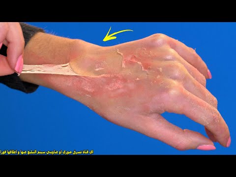 How To Peel Wrinkles | And Make Your Skin Look 20 Years Younger (100% WORKS)