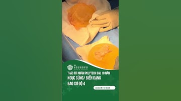 Tháo túi ngực có nguy hiểm không, tháo túi ngực cần được bác sĩ có chuyên môn và tay #thaotuinguc