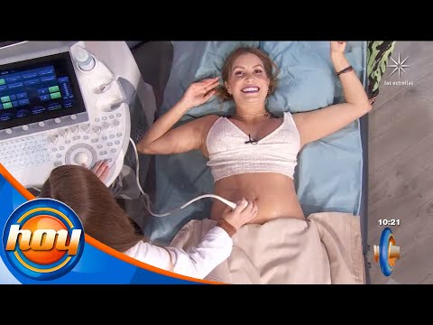 Conocimos al bebé de Andrea Escalona gracias al ultrasonido 6-D | Programa hoy