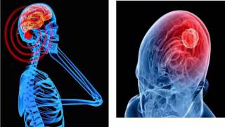 Brain Cancer Treatment | Brain Cancer Grow Fast in Human Life | Health4Save Updated 2016