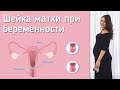 Какая длина шейки матки считается нормой?