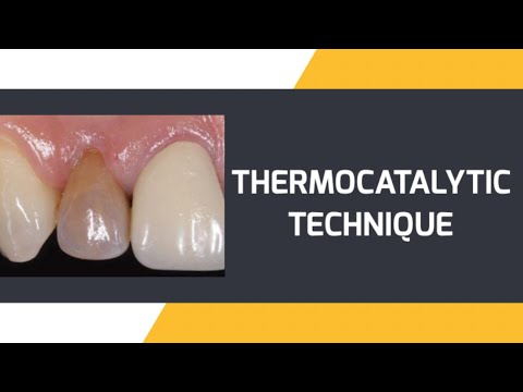 BLEACHING [PART 8] (NON VITAL - THERMOCATALYTIC TECH)