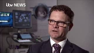 ScanNav - Tomorrow's AI ultrasound technology is here