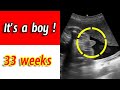 33 Weeks Ultrasound - Baby Boy !