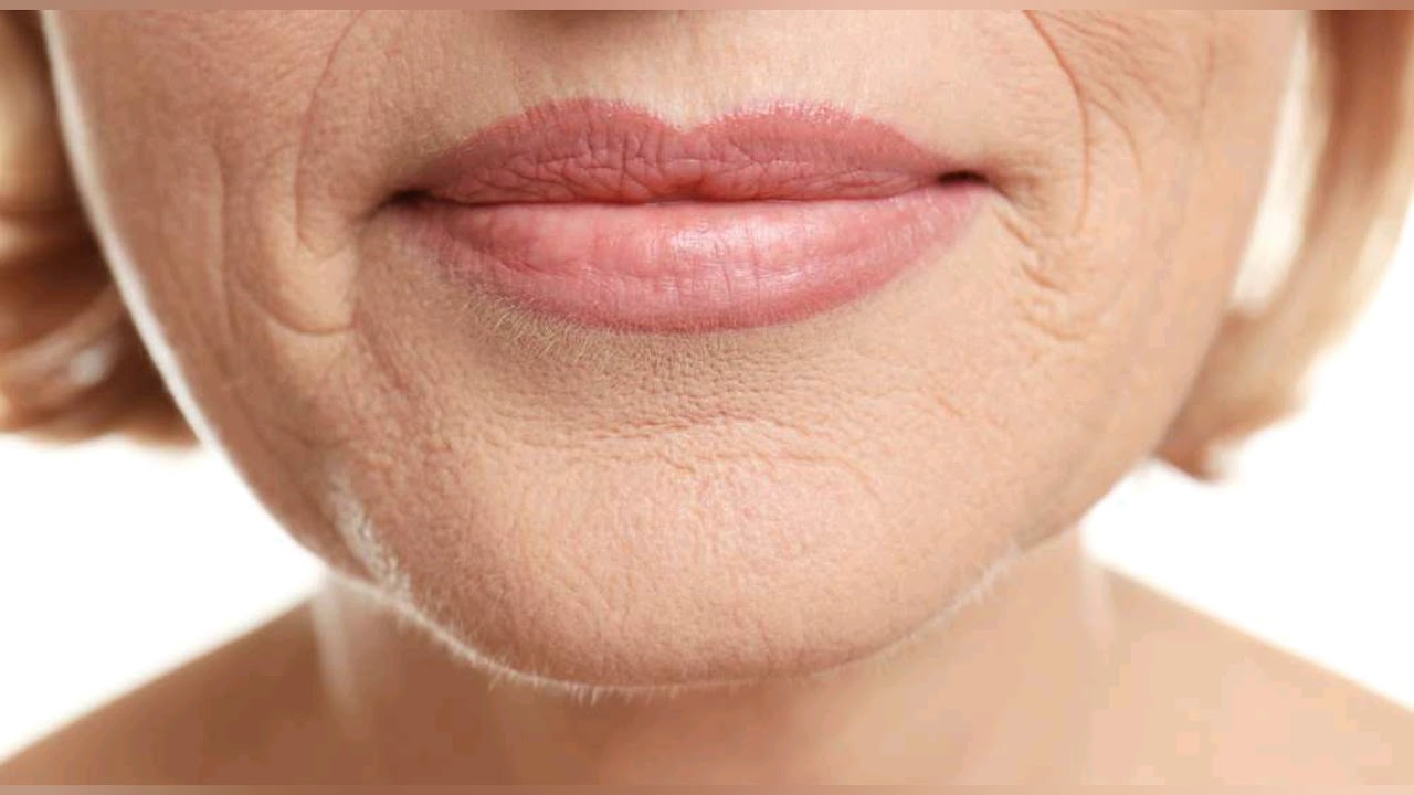 ¿Sabía qué?:😱😲 mira como ya puede eliminar las arrugas de tu BOCA