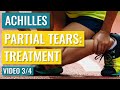 Partial Achilles Tear Treatment