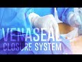 Venaseal closure system  vein care  vein treatment center