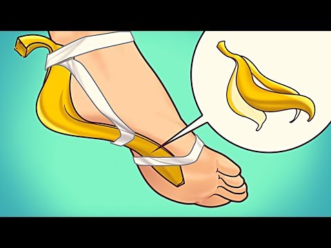 Usa la Buccia di Banana in Questo Modo Per Una Settimana e Scopri Cosa Succede al Tuo Corpo