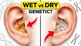 What Your Earwax Type Reveals About Your Ancient Ancestry?
