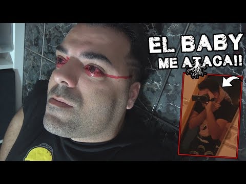 BABY BLUE ME ATACA !! *El Final De Youman*