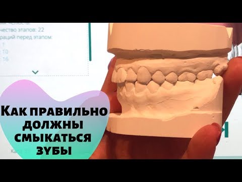 Правильный прикус, Как правильно должны смыкаться зубы при правильном прикусе?