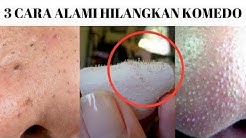 3 Cara Alami Menghilangkan Komedo Dengan Cepat / How To Get Rid Of Blackheads & Whiteheads - Durasi: 10.03. 