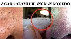 3 Cara Alami Menghilangkan Komedo Dengan Cepat / How To Get Rid Of Blackheads & Whiteheads - Durasi: 10.03. 