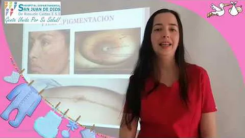 ¿Qué aspecto tienen las areolas al principio del embarazo?