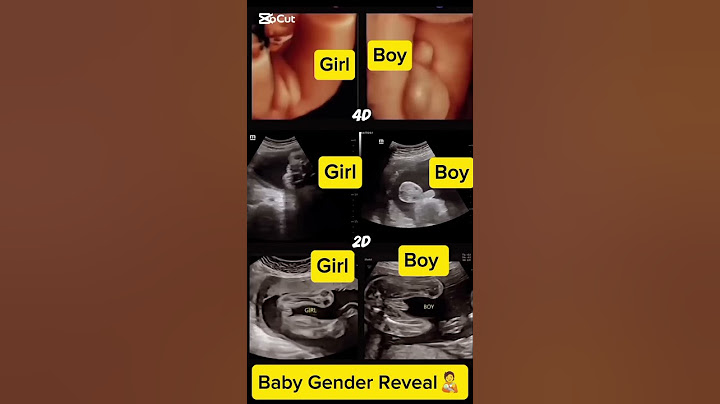 Baby Gender reveal. #ItsABoy  #ItsAGirl  #BoyOrGirl  #BabyReveal  #MomToBe #DadToBe  #BabyOnTheWay