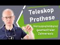 Teleskop Prothese: Herausnehmbarer gaumenfreier Zahnersatz | Dr. Jens-Uwe Gössel