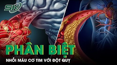 Chuyên gia chỉ cách phân biệt nhồi máu cơ tim với đột quỵ | SKĐS