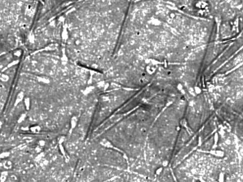 Spermbots in Action