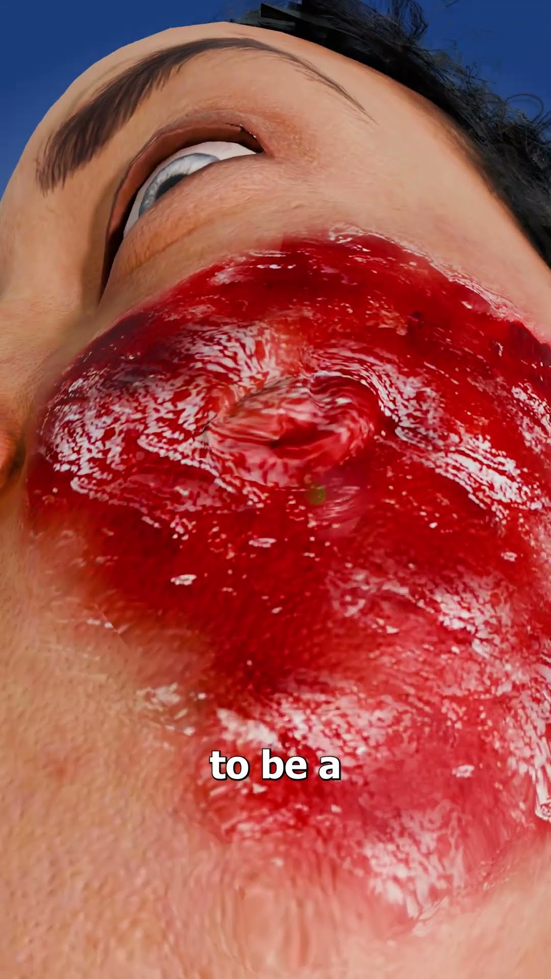 Flesh-Eating Bacteria From A Rusty Razor ?