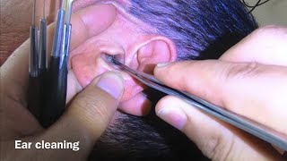 耳掃除 귀 청소 Ear Cleaning #304