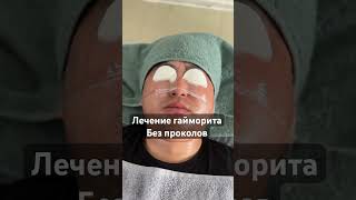 Лечение гайморита без операции #ангина #гайморит #бронхит #здоровье #горло #ларингит