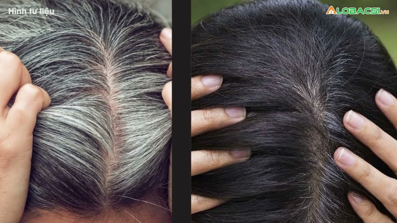 Nên uống hà thủ ô vào thời điểm nào là tốt nhất? Nên uống hà thủ ô vào thời điểm nào là tốt nhất?