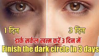 How to Remove Dark Circles Naturally in 3 Days | Dark  circle kaise hataye |  Ranu Patel