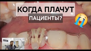 видео: СТОМБУДНИ#29. У МЕНЯ ПЛАЧУТ ПАЦИЕНТЫ(( картинка: СТОМБУДНИ#29. У МЕНЯ ПЛАЧУТ ПАЦИЕНТЫ((