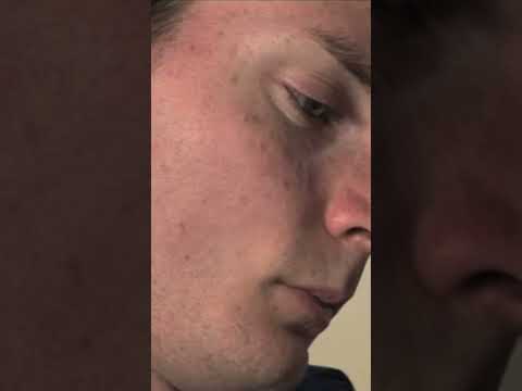 A tumour is eating away his vertebrae | Last Chance Surgery | Medical Documentary