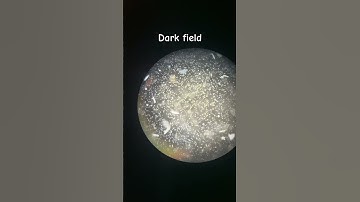 Dark field microscopy #microscopics #science #microscope