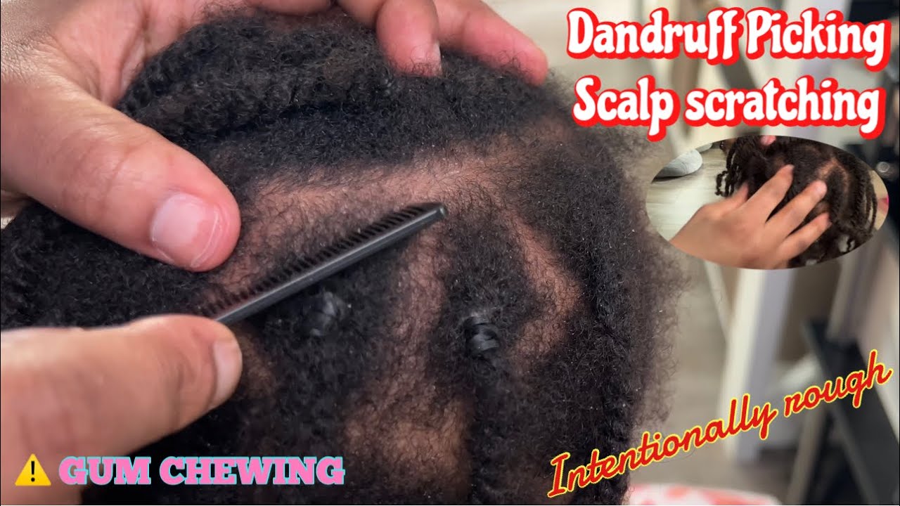 Dandruff scratching (GUM CHEWING VERSION) - loFi ASMR •rough•