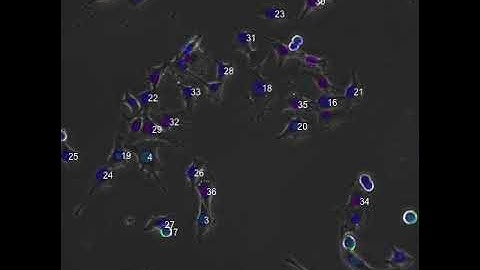 48h Time Lapse after eGFP mRNA Microinjected Single MCF Cells