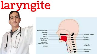 la laryngite