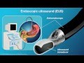 Understanding EUS-FNA