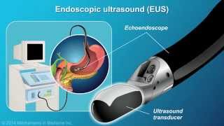 Understanding EUS-FNA