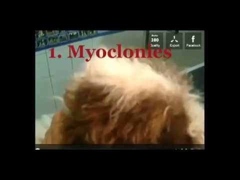 Vidéo: Maladie De Contraction Musculaire (myoclonie) Chez Le Chien